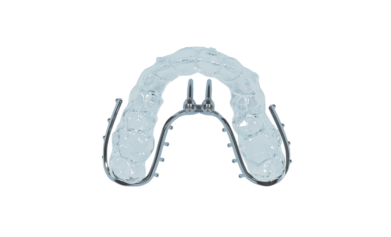 aligners